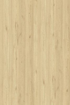 KAJARIA MIRROR FINISH ACACIA AMBER LAMINATE (KL 41 - 7118)